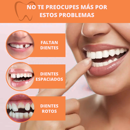 (COMPRA 1 LLEVA 2) Carillas Dentales Snap-On Smile: Tu Sonrisa Perfecta en Segundos, Sin Dentista