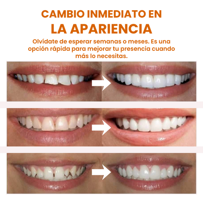 (COMPRA 1 LLEVA 2) Carillas Dentales Snap-On Smile: Tu Sonrisa Perfecta en Segundos, Sin Dentista