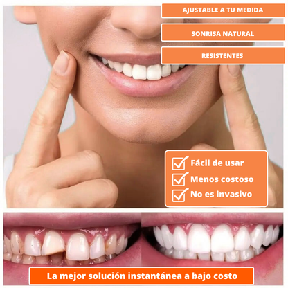 (COMPRA 1 LLEVA 2) Carillas Dentales Snap-On Smile: Tu Sonrisa Perfecta en Segundos, Sin Dentista